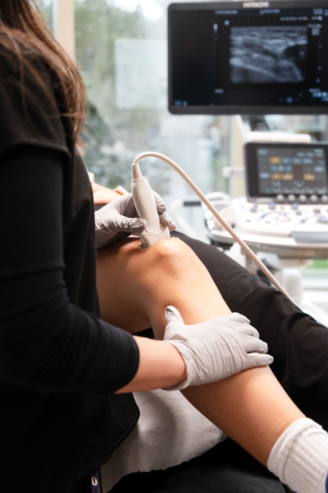 Infiltration du genou sous guidage échographique