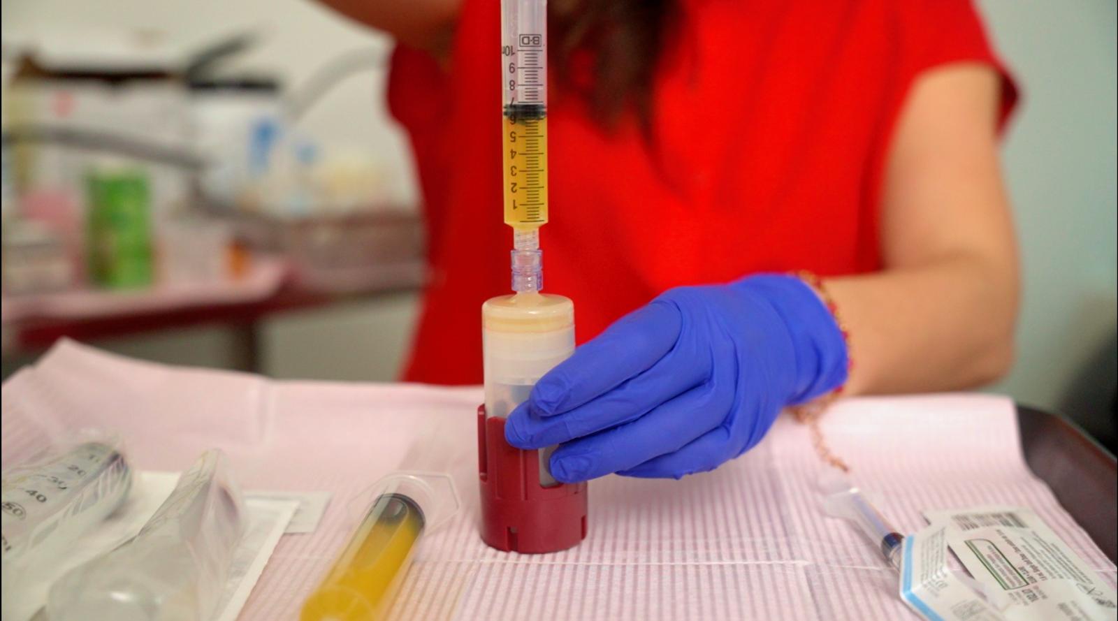 PRP — Plasma riche en plaquettes